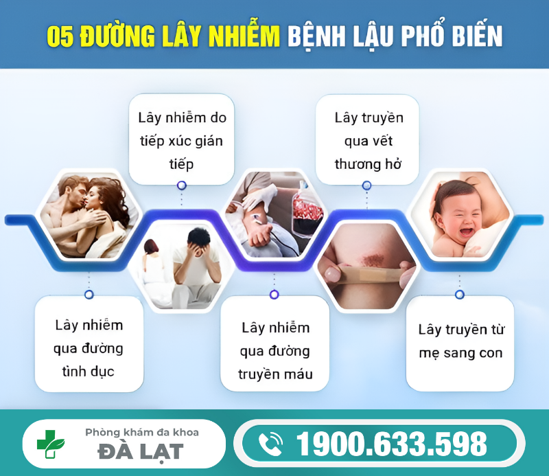 Hình ảnh minh họa
